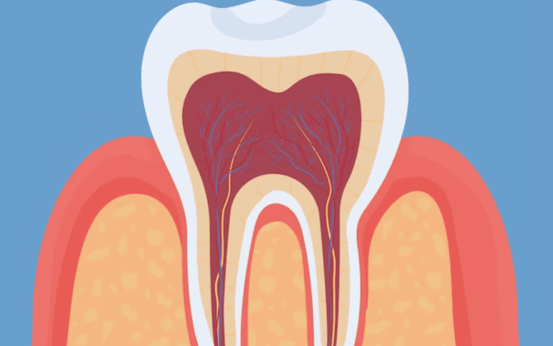 the main causes of root canal infections